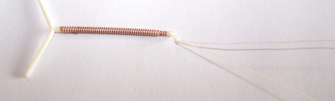 Image de 29 ans avec un stérilet oublié : l’histoire incroyable d’une maternité mise en veille